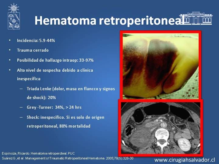 Presentaciones Depto Cirug A Hospital Del Salvador